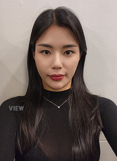 การผ่าตัดโครงหน้า, โครงหน้า, ฉีดไขมัน, โรงพยาบาลผ่าตัดโครงหน้า, ฉีดไขมันใบหน้า, บริเวณฉีดไขมัน, การผ่าตัดไขมัน