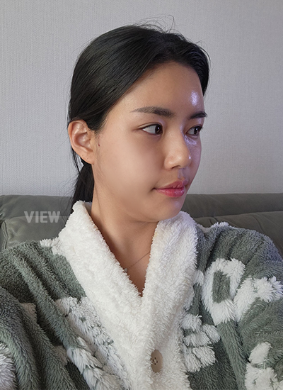 รีวิวครบ 14 วันของการผ่าตัดโครงหน้า, รีวิวครบ 14 วันของการผ่าตัดแก้จมูก, การดูแลหลังผ่าตัด 2อาทิตย์