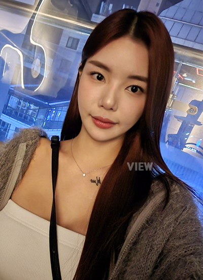 รีวิวครบ2 เดือนการผ่าตัดโครงหน้า, การตัดไหมของการผ่าตัดโครงหน้า, รีวิวครบ 2เดือนของการฉีดไขมัน