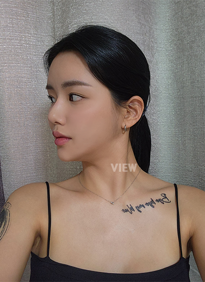 รีวิวครบ 5 เดือนของการผ่าตัดโครงหน้า, รีวิวครบ 5 เดือนของการฉีดไขมัน, การดูแลตัวเองหลังผ่าตัด, ข้อควรระวังหลังผ่าตัด