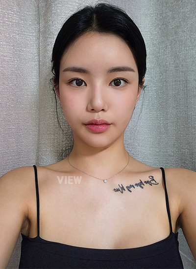 โรงพยาบาลศัลยกรรมเกาหลี, โรงพยาบาลศัลยกรรมวิว, โรงพยาบาลวิว, โรงพยาบาลวิวเกาหลี, ปรับโครงหน้า, รีวิวเกาหลี