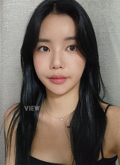 รีวิวครบ 5 เดือนของการผ่าตัดโครงหน้า, รีวิวครบ 5 เดือนของการฉีดไขมัน, การดูแลตัวเองหลังผ่าตัด, ข้อควรระวังหลังผ่าตัด