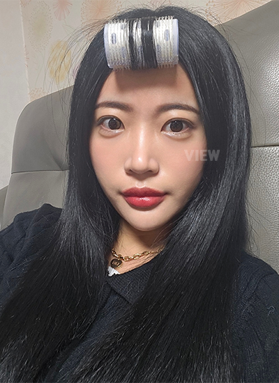 รีวิว 3 อาทิตย์หลังทำตาสองชั้น, วิธีดูแลหลังการผ่าตัดศัลยกรรมตา,และข้อควรระวัง, โรงพยาบาลวิว, เกาหลี, ศัลยกรรมตา,การเปิดหัวตา,การเปิดหางตา,การเปิดใต้ตา