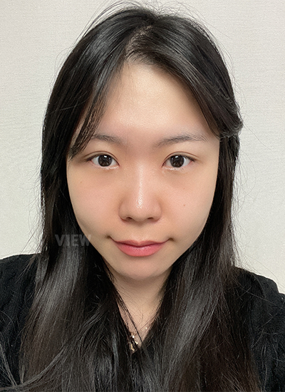 รีวิว 2 อาทิตย์หลังทำตาสองชั้น, วิธีดูแลหลังการผ่าตัดศัลยกรรมตา,และข้อควรระวัง, โรงพยาบาลวิว, เกาหลี, ศัลยกรรมตา,การเปิดหัวตา,การเปิดหางตา,การเปิดใต้ตา
