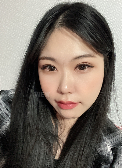 รีวิว 4 อาทิตย์หลังทำตาสองชั้น, วิธีดูแลหลังการผ่าตัดศัลยกรรมตา,และข้อควรระวัง, โรงพยาบาลวิว, เกาหลี, ศัลยกรรมตา,การเปิดหัวตา,การเปิดหางตา,การเปิดใต้ตา