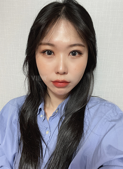 รีวิว 4 อาิทตย์หลังทำตาสองชั้น, วิธีดูแลหลังการผ่าตัดศัลยกรรมตา,และข้อควรระวัง, โรงพยาบาลวิว, เกาหลี, ศัลยกรรมตา,การเปิดหัวตา,การเปิดหางตา,การเปิดใต้ตา