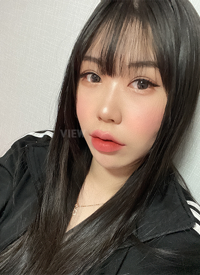 รีวิว 2 เดือนหลังทำตาสองชั้น, วิธีดูแลหลังการผ่าตัดศัลยกรรมตา,และข้อควรระวัง, โรงพยาบาลวิว, เกาหลี, ศัลยกรรมตา,การเปิดหัวตา,การเปิดหางตา,การเปิดใต้ตา