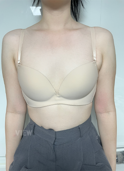 ริวิวโรงพยาบาลศัลยกรรมวิว, ดูดไขมัน, การลดขนาดปานนม, Motiva, ศัลยกรรมหน้าอก, รีวิวศัลยกรรมหน้าอกที่โรงพยาบาลศัลยกรรมวิว