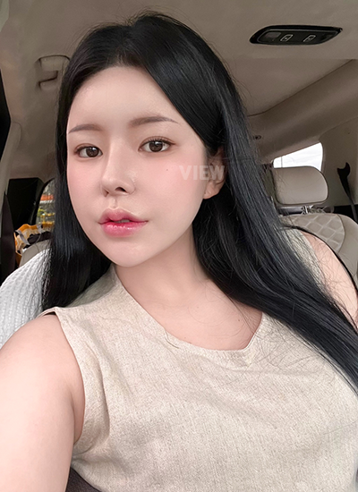 รีวิว 3 เดือน, แก้ตาสองชั้นเกาหลี, รูปก่อนหลังทำศัลยกรรม, เปิดหัวตาเกาหลี,เสริมจมูก, ดูดไขมันเหนียง, ตาสองชั้นสวยๆ, โรงพยาบาลวิว, ศัลยกรรมเกาหลี