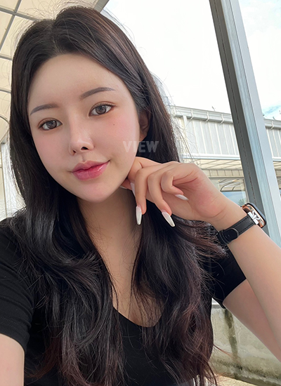 รีวิว 4 เดือน, แก้ตาสองชั้นเกาหลี, รูปก่อนหลังทำศัลยกรรม, เปิดหัวตาเกาหลี,เสริมจมูก, ดูดไขมันเหนียง, ตาสองชั้นสวยๆ, โรงพยาบาลวิว, ศัลยกรรมเกาหลี