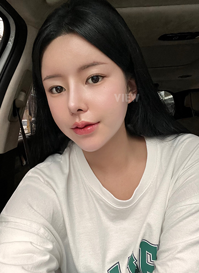 รีวิวครบ 7 วันของการผ่าตัดโครงหน้า, รีวิวครบ 7 วันของการผ่าตัดแก้จมูก, การดูแลหลังผ่าตัด 1อาทิตย์