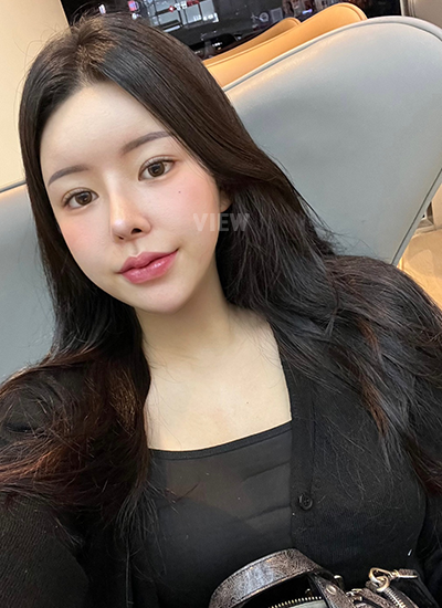 รีวิว 5 เดือน, แก้ตาสองชั้นเกาหลี, รูปก่อนหลังทำศัลยกรรม, เปิดหัวตาเกาหลี,เสริมจมูก, ดูดไขมันเหนียง, ตาสองชั้นสวยๆ, โรงพยาบาลวิว, ศัลยกรรมเกาหลี