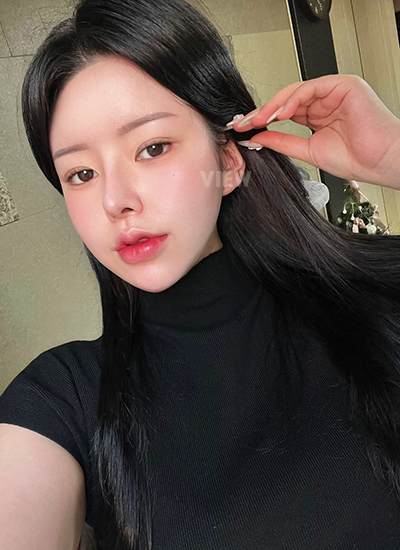 รีวิว 9 เดือน, แก้ตาสองชั้นเกาหลี, รูปก่อนหลังทำศัลยกรรม, เปิดหัวตาเกาหลี,เสริมจมูก, ดูดไขมันเหนียง, ตาสองชั้นสวยๆ, โรงพยาบาลวิว, ศัลยกรรมเกาหลี