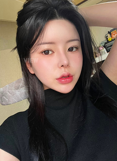 รีวิว 8 เดือน, แก้ตาสองชั้นเกาหลี, รูปก่อนหลังทำศัลยกรรม, เปิดหัวตาเกาหลี,เสริมจมูก, ดูดไขมันเหนียง, ตาสองชั้นสวยๆ, โรงพยาบาลวิว, ศัลยกรรมเกาหลี