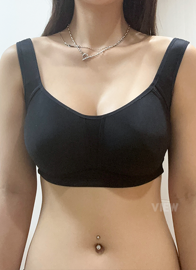 รีวิวครบ 14 วันของการเสริมหน้าอก, ข้อห้ามหลังเสิรมหน้าอก, การดูแลหลังผ่าตัด 2 อาทิตย์, ซิลิโคนโมติว่า, ซิลิโคน Motiva