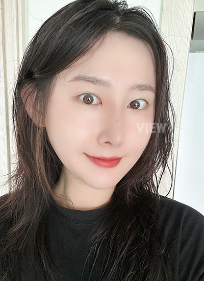 รีวิวศัลยกรรมจมูก, การดูแลหลังศัลยกรรมจมูก, ข้อควรระวังหลังศัลยกรรมจมูก, หลังผ่าตัด 2 เดือน, รีวิว ฉีดไขมัน ปรับโครงหน้าเกาหลี