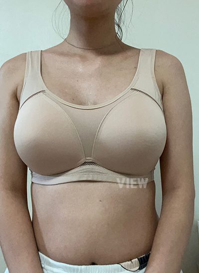 ริวิวโรงพยาบาลศัลยกรรมวิว, แก้หน้าอก, Sebbin, ศัลยกรรมหน้าอก, รีวิวศัลยกรรมหน้าอกที่โรงพยาบาลศัลยกรรมวิว