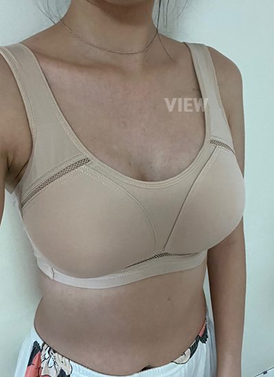 ริวิวโรงพยาบาลศัลยกรรมวิว, แก้หน้าอก, Sebbin, ศัลยกรรมหน้าอก, รีวิวศัลยกรรมหน้าอกที่โรงพยาบาลศัลยกรรมวิว