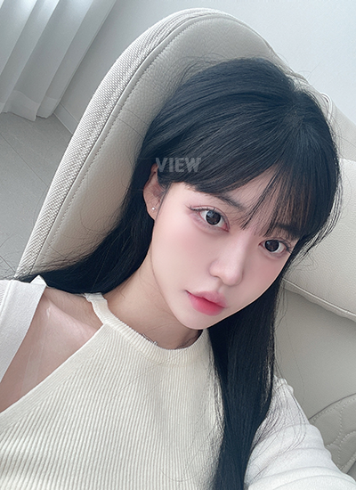 เติมไขมันหน้าครบ 4 เดือน
