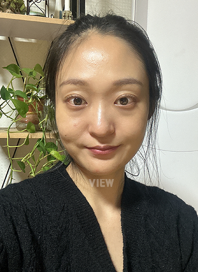 รีวิวเกลี่ยไขมันใต้ตา, รีวิวศัลยกรรมจมูก, การดูแลหลังผ่าตัด