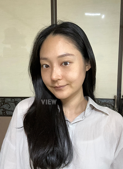 รีวิวเกลี่ยไขมันใต้ตาครบ 7 วัน, รีวิวศัลยกรรมจมูก ครบ 7 วัน, การดูแลหลังผ่าตัด, รีวิวหลังผ่าตัด