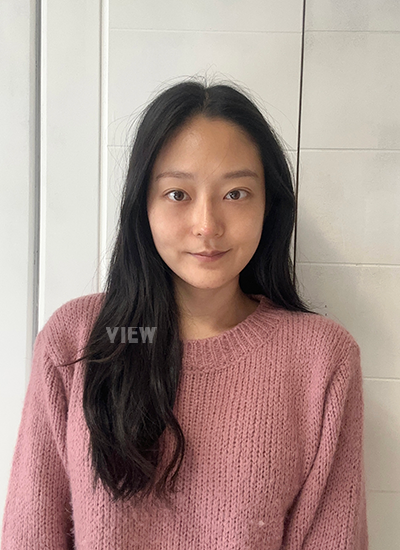 รีวิวเกลี่ยไขมันใต้ตาครบ 14 วัน, รีวิวศัลยกรรมจมูก ครบ 14 วัน, การดูแลหลังผ่าตัด, รีวิวหลังผ่าตัด 2 อาทิตย์
