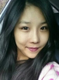 [Combi buried + front slit + posterior slit + natural line rhinoplasty + fat grafting] Yoo Ji-hye