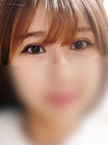 [Eye correction + brow lift] Minah Kim
