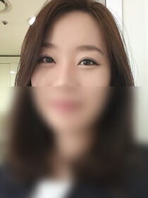 [Open back + front opening + remove fat under the eyes] Dayoung Choi