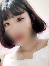 [Non-incision eyelid correction + front slit + lower slit] Mijeong Kim