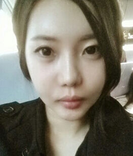[V-line + cheekbone reduction] Kim Hyo-kyung