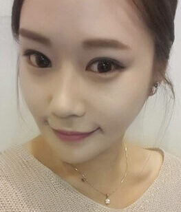 [Doll line (V line) + cheekbone reduction + slit in the back + slit in the bottom] Park Hee-jin