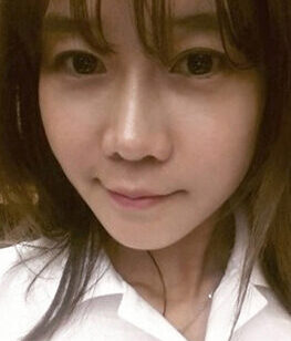[Natural V line + cheekbone reduction + forehead implant + aristocratic surgery + anterior cheek implant + nose surgery] Bae Soo-hyun