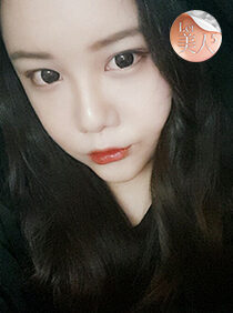 [Doll line V line + cheekbone reduction + nose surgery] Go Soo Bin