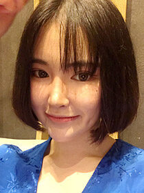 [Natural V line + cheekbone reduction + thread lifting + accu lifting] Yujin Kim
