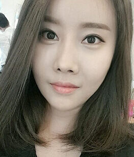 [Doll line (V-line) + rhinoplasty + eye reoperation + back slit reoperation + lower slit] Park Hyo-rin