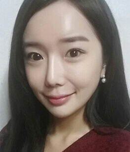 [Doll line (V line) + cheekbone reduction + non-incision eyelid correction + rhinoplasty + noble surgery + fat grafting] Eunji Lee