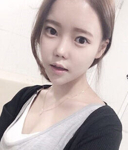 [Doll line (V line) + cheekbone reduction] Kim Young-sun