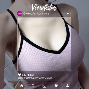 [Breast Augmentation] Kim Ha-yoon