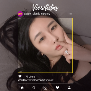 [Nose Surgery] Kang Hee-yeon
