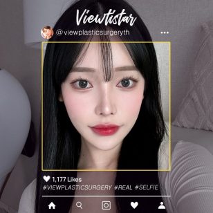 [โครงหน้า 3 จุด+ทำตาสองชั้น+เสริมจมูก] Koo Dohui | Plastic Surgery Korea