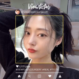 [จัดเรียงไขมันใต้ตา + เสริมจมูก] Lee Hyeri | Plastic Surgery Korea