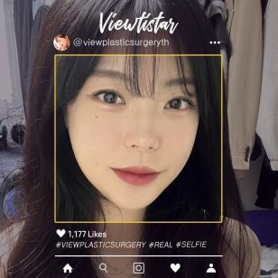 [โครงหน้า 3 จุด+จัดเรียงไขมันใต้ตา+ฉีดไขมันหน้า] Lee Minji | Plastic Surgery Korea