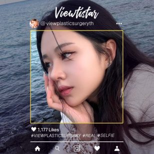 [เสริมจมูก] Lim Sohyeon | Plastic Surgery Korea