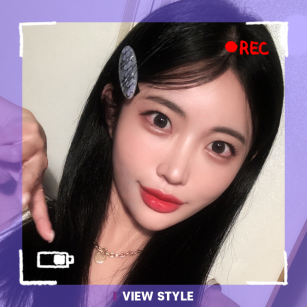 [รีวิวศัลยกรรมตาสองชั้น] ปรับกล้ามเนื้อตา ทำตาสองชั้นที่เกาหลี โรงพยาบาลวิว